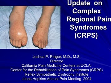 Update on CRPS - Reflex Sympathetic Dystrophy Association of ...