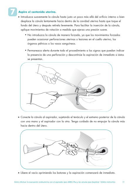 IPAS AMEU Plus.pdf