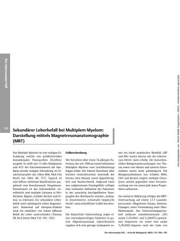 Sekundärer Leberbefall bei Multiplem Myelom ... - An-Najah Staff