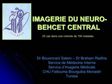 IMAGERIE DU NEURO- BEHCET CENTRAL