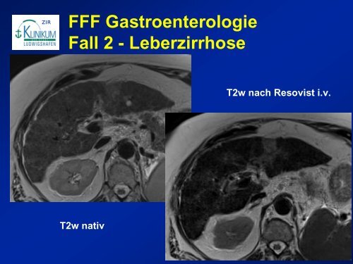 Diagnostik von lebertumoren - State of the Art