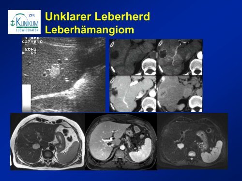 Diagnostik von lebertumoren - State of the Art