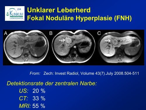 Diagnostik von lebertumoren - State of the Art