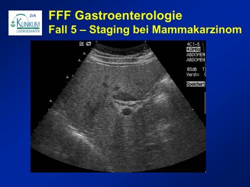 Diagnostik von lebertumoren - State of the Art