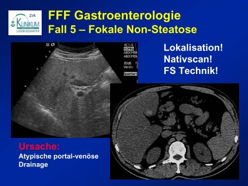 Diagnostik von lebertumoren - State of the Art