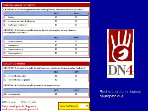 EVALUATION DE LA DOULEUR