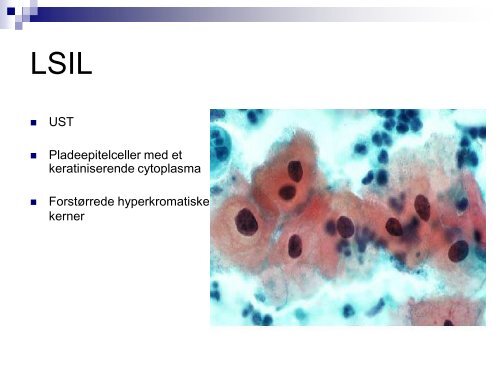 Undervisningmateriale â LSIL - Dansk Cytologiforening