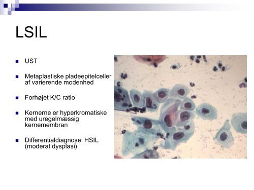 Undervisningmateriale â LSIL - Dansk Cytologiforening