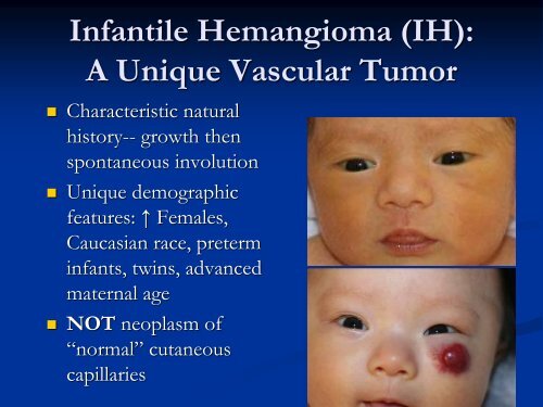 Infantile Hemangioma - CHU Sainte-Justine - SAAC