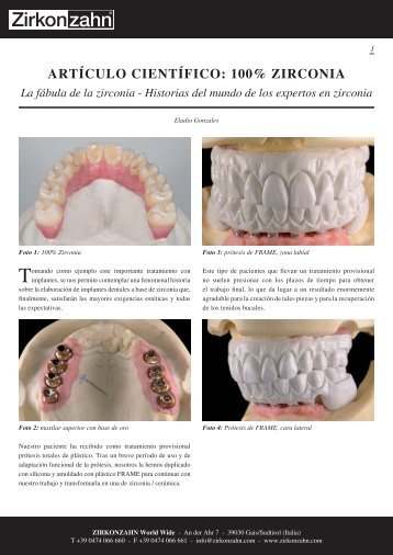 ARTÃCULO CIENTÃFICO: 100% ZIRCONIA La fÃ¡bula de ... - Zirkonzahn