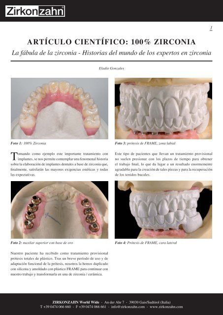 ARTÃCULO CIENTÃFICO: 100% ZIRCONIA La fÃ¡bula de ... - Zirkonzahn