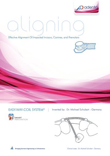 EASY-WAY-COIL SYSTEM® | - Adenta