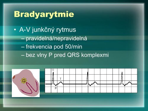 6. PraktickÃ© cviÄenie VII.