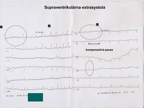 6. PraktickÃ© cviÄenie VII.