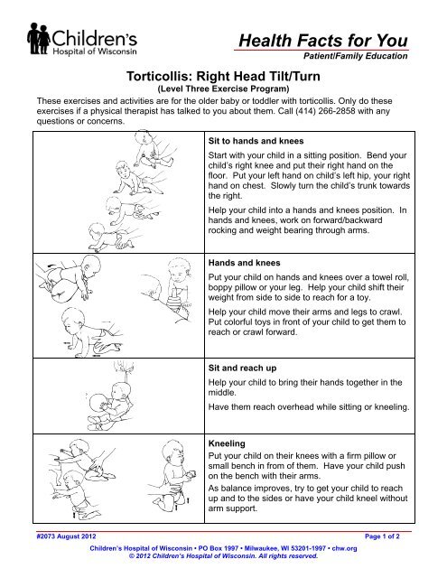 Torticollis: Right Head Tilt/Turn - Children's Hospital of Wisconsin