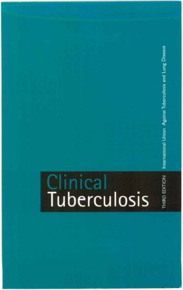 Crofton's Clinical Tuberculosis Third Edition