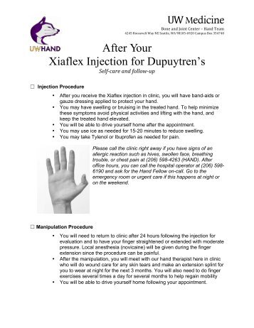 Xiaflex Injection for Dupuytrens Contracture