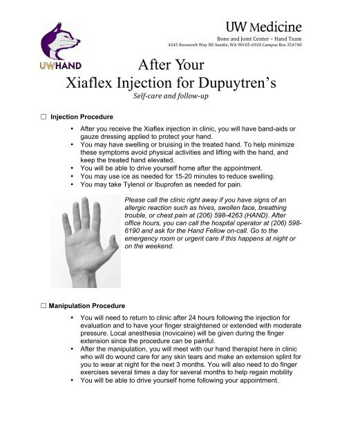 xiaflex-injection-for-dupuytrens-contracture