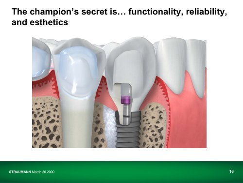 Straumann Management Breakfast - International Dental Show ...