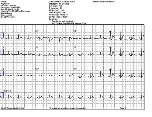 Sample ECG Printout - Nasiff