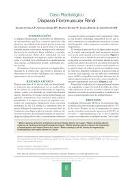 Caso RadiolÃ³gico Displasia Fibromuscular Renal - Hospital General ...