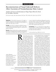 Reconstruction of Nasal Sidewall Defects After Excision of ... - Dr. Vuyk
