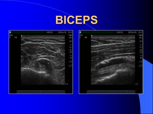 IN OFFICE MUSCULOSKELETAL ULTRASOUND