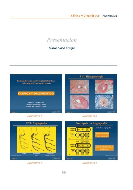 Aula sobre Trasplantes de Órganos Sólidos - Roche Trasplantes