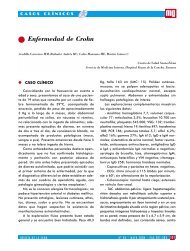 Enfermedad de Crohn - Revista Medicina General y de Familia