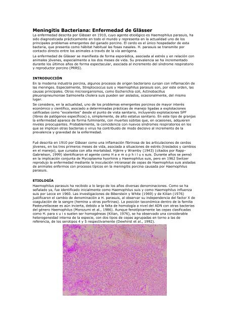 Meningitis Bacteriana.pdf - Centro de InformaciÃ³n de Actividades ...