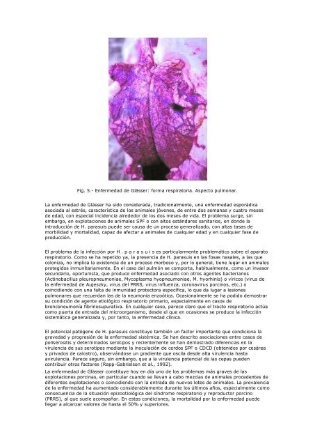 Meningitis Bacteriana.pdf - Centro de InformaciÃ³n de Actividades ...