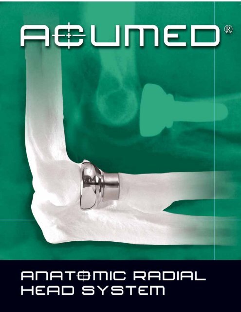 Acumed Radial Head Replacement