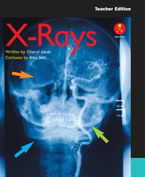 TE X-Rays pages