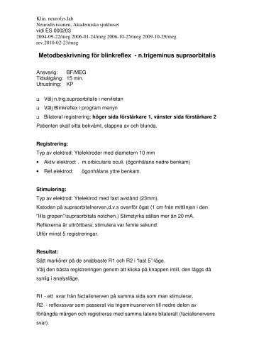 Metodbeskrivning fÃ¶r blinkreflex