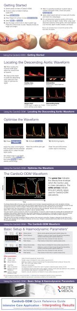 Using CardioQ–ODM in the ICU - Deltex Medical