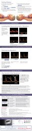 Using CardioQ–ODM in the ICU - Deltex Medical