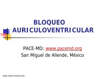 BLOQUEO AURICULOVENTRICULAR - Reeme.arizona.edu