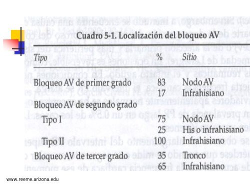 BLOQUEO AURICULOVENTRICULAR - Reeme.arizona.edu