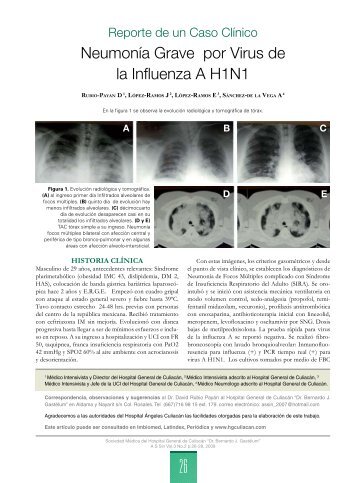 NeumonÃ­a Grave por Virus de la Influenza A H1N1 - Hospital ...