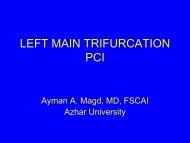 LEFT MAIN TRIFURCATION PCI