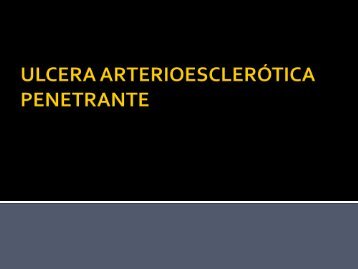 ULCERA ARTERIOESCLERÓTICA PENETRANTE