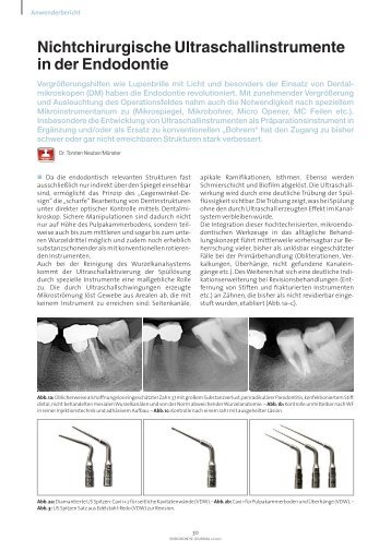 Nichtchirurgische Ultraschallinstrumente in der ... - Vdw-dental.com