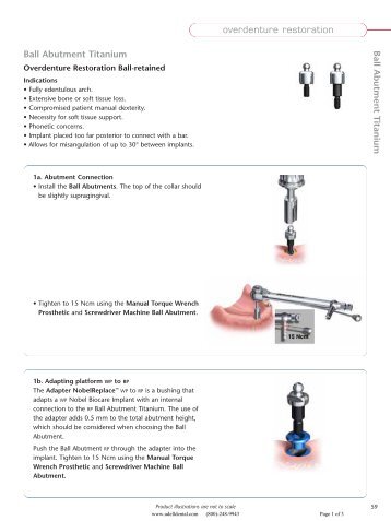 Nobel Overdenture Ball Abutment - Udell dental laboratory