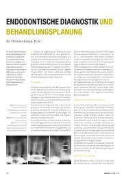 Endodontische Diagnostik und Behandlungsplanung - zahniportal.de