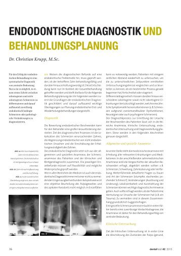 Endodontische Diagnostik und Behandlungsplanung - zahniportal.de