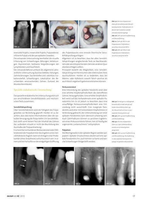 Endodontische Diagnostik und Behandlungsplanung - zahniportal.de