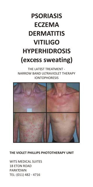 Psoriasis Eczema Dermatitis Vitiligo Dermatology Psoriasis Eczema Dermatitis Vitiligo Dermatology