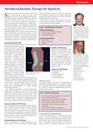 Intrathecal Baclofen Therapy for Spasticity - Advances in Clinical ...