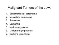 Malignant Tumors of the Jaws