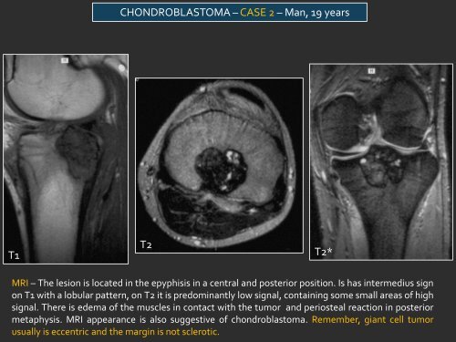 LYTIC EPIPHYSEAL LESIONS - H.U.C.